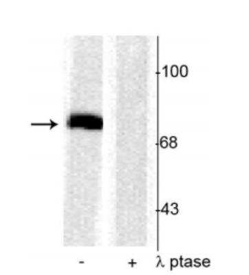 Western Blot: Synapsin I [p Ser603] Antibody [NB300-181]